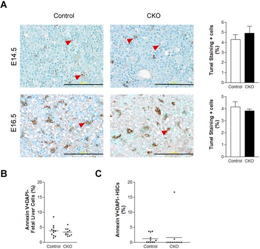 Figure 5. FIP200 deletion did not affect fetal liver cell apoptosis. (A) Fetal liver tissue sections from control and CKO mice at E14.5 and E16.5 were analyzed by TUNEL assays. Arrowheads indicate the positively stained apoptotic cells. Data on the right- side graphs are mean ± SE. n = 4-5. Scale bars, 200 μm. (B-C) Annexin V labeling of fetal liver cells (B) or fetal HSCs (C) from E14.5 control and CKO embryos. Data are mean ± SE.