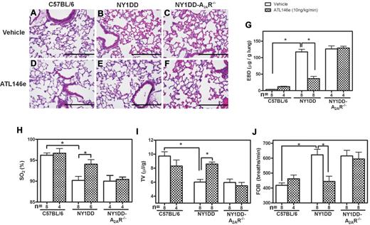 Figure 4. ATL146e treatment decreases pulmonary dysfunction in NY1DD mice by activation of the A2AR. C57BL/6, NY1DD, or NY1DD x A2AR−/− mice were treated with ATL146e (10 ng/kg/minute, 3 days) or vehicle (saline, 0.2% DMSO). (A-F) Lung sections from NY1DD mice, but not NY1DD x A2AR−/− mice have reduced alveolar thickening and reduced vaso-occlusion after ATL146e treatment. (G-H) NY1DD mice, but not NY1DD x A2AR−/− mice, had decreased vascular permeability and increased oxygen saturation after ATL146e treatment. (I-J) NY1DD mice, but not NY1DD x A2AR−/− mice, displayed improved breathing parameters after ATL146e treatment. Data were analyzed by 1-way ANOVA with Neuman-Keuls posttesting; *P < .05. SO2: arterial oxygen saturation.