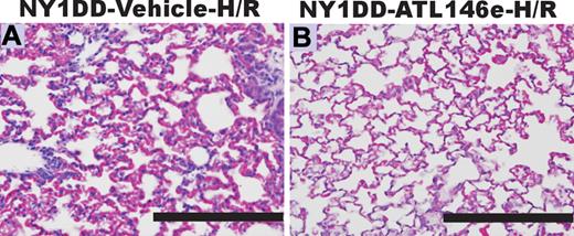 Figure 5. ATL146e treatment decreases pulmonary injury during hypoxia-reoxygenation (H-R) of NY1DD mice. NY1DD mice were subjected to 3 hours of hypoxia (8% oxygen) and 18 hours of reoxygenation. Lungs were then removed, inflation-fixed, and stained with H&E or immunostained for neutrophils. Three hours after reoxygenation, mice were implanted with Alzet minipumps containing either vehicle (A) or ATL146e (10 ng/kg/minute; B). The sections shown are typical of 4 replicates. Bars, 200 μm.