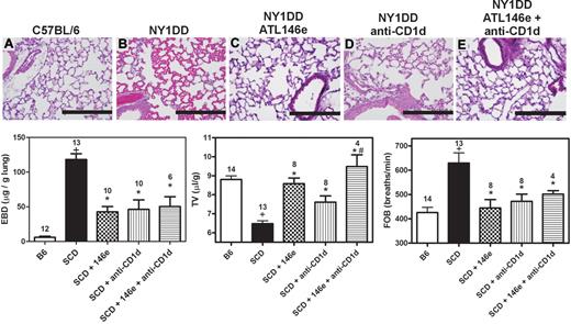 Figure 7. Protective effects of ATL146e and anti-CD1d treatments to reduce pulmonary inflammation in NY1DD. NY1DD mice were treated with either ATL146e (10 ng/kg/minute, 3 days), anti-CD1d (10 μg/g/day, 2 days), or a combination of both. All treatments resulted in significantly improved pulmonary parameters. (A-E) Representative H&E staining from sections of lungs at baseline illustrating reduced alveolar thickening and vaso-acclusion as a result of ATL146e or anti-CD1d treatment. (F-H) ATL146e or anti-CD1d treatment improved parameters of pulmonary function in NY1DD mice. Data were analyzed by 1-way ANOVA with Neuman-Keuls posttesting. P < .05, +NY1DD vs C57BL/6; *Different from NY1DD controls; # > anti-CD1d alone.