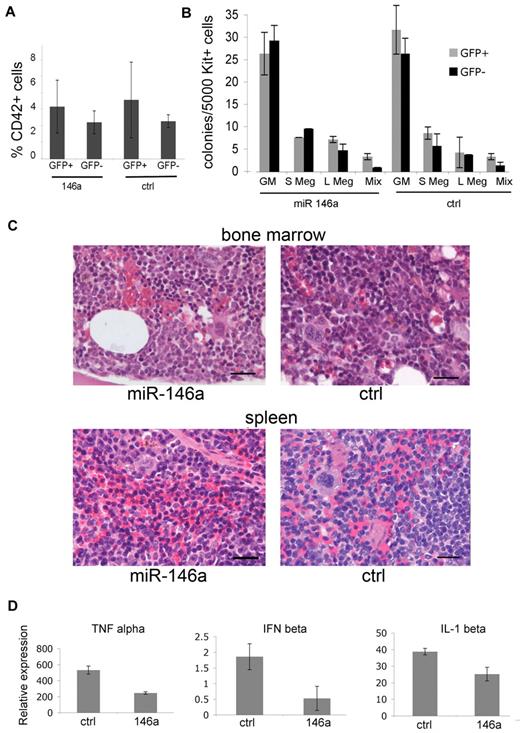 Figure 5. Overexpression of functional miR-146 does not alter megakaryopoiesis. (A) Quantification of megakaryocytes in the bone marrow of transplanted mice. Bone marrow suspensions were stained with anti-CD42 and analyzed by flow cytometry. Similar results were obtained from the spleen (data not shown). Differences between GFP+ (P = .12) and GFP− groups (P = .23) were not significant. There were n = 5 mice analyzed from each group at 16 weeks after transplantation. (B) Megakaryocyte colony assays. Bone marrow cells were isolated 16 weeks after transplantation, fractionated by flow cytometry into c-kit+/GFP+ and c-kit+/GFP− subsets representing microRNA virus–infected and –uninfected populations, respectively, and analyzed in hematopoietic colony assays containing Tpo, Il-3, and IL-6. Colonies were enumerated at 7-8 days. Megakaryocytes were identified by staining with acetylthiocholiniodide. GM indicates granulocyte-macrophage; S Meg indicates small megakaryocytic colonies (3-5 cells); L Meg indicates large megakaryocytic colonies (> 5 cells); Mix indicates mixed colonies. There were n = 4 mice analyzed from each group. P > .1 for all groups. (C) Histology of hematopoietic tissues. Bone marrow and spleen from transplanted mice stained with hematoxylin-eosin. Tissue architecture, megakaryocyte numbers, and megakaryocyte morphology were similar in miR-146a–overexpressing and control mice. The mice shown here contained approximately 35% GFP-positive cells in bone marrow and spleen. Five similar pairs of mice were analyzed, and representative results are shown. Scale bars represent 20 μm. (D) Overexpressed miR-146a inhibits innate immune response in cultured macrophage. At 16 weeks transplantation, c-kit+/GFP+ bone marrow cells were purified by flow cytometry and cultured in media containing macrophage colony stimulating factor (M-CSF). After 7-8 days, the cells remained GFP+ and > 90% expressed the macrophage marker Mac1. The cells were stimulated with LPS for 16 hours and 1 day later harvested for RNA extraction. The expression of cytokine-encoding mRNAs Tnf (TNFα), Infb1 (interferon β), and Il1b (IL-1β) were analyzed by Q-RT-PCR. mRNA levels are plotted relative to levels in unstimulated cells, which were assigned an arbitrary value of 1. P values were .0001, .0008, and .0048, respectively. Results indicate triplicate RT-PCR assessments performed in 2 mice from each group.