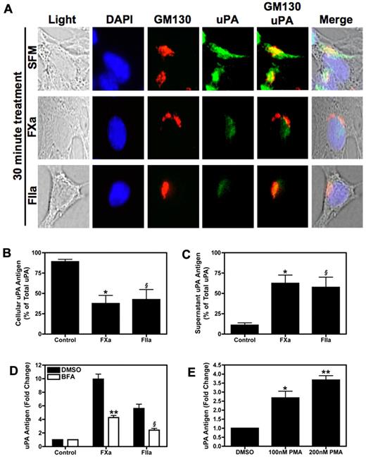 Figure 4. Stimulation of 4T1 cells with FXa or thrombin induces uPA secretion. (A) Intracellular uPA staining. Subconfluent 4T1 cells were starved overnight then incubated with SFM, FXa, or thrombin for 30 minutes. The cells were then fixed and permeablized on glass chamber slides. Cells were incubated with both uPA-fluorescein isothiocyanate (green) and GM130-Alexa Fluor555 (red) antibodies, then counterstained with DAPI (blue). Slides were viewed on an Olympus BX51WI fluorescence microscope fitted with an Olympus DP70 cooled digital color camera. Total magnification is 400 × (10 × ocular; 40 × objective). DP Controller version 2.2.1.227 software was used for image acquisition. GraphicConverter X V5.4 was used to compile images. (B-C) Serum starved 4T1 cells were incubated with FXa (125nM) or thrombin (20nM) for 1 hour. Cellular (B) and culture supernatant (C) uPA expressed as percentage of total uPA in 4T1 cells. Results are shown as mean ± SEM of 3 independent experiments. *P ≤ .05 (control versus FXa treated) and §P ≤ .05 (control versus thrombin treated). (D) Cells were treated with BFA (10 μg/mL) or vehicle control then stimulated with FXa (125nM) or thrombin (20nM) for 1 hour. uPA was quantified in cell culture supernatant. **P ≤ .05 (control versus FXa treated) and §P ≤ .05 (control versus thrombin treated). (E) uPA levels in the culture supernatant of 4T1 cells treated with 100nM or 200nM PMA for 1 hour. *P ≤ .05 and **P ≤ .001 (control versus PMA treated). Results are shown as mean ± SEM of 3 independent experiments.