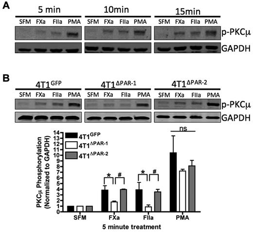 Figure 5. Coagulation proteases activate the secretory pathway in the 4T1 cell line. (A) 4T1 cells were treated for the indicated amount of time with SFM, FXa, thrombin, or 200nM PMA. Blots were probed with antibodies for p-PKCμ and GAPDH. Data shown is representative of 3 independent experiments. (B) 4T1GFP, 4T1ΔPAR-1, and 4T1ΔPAR-2 cells were treated with SFM, FXa, thrombin, or PMA for 5 minutes. Blots were probed with antibodies for p-PKCμ and GAPDH. Phosphorylated PKCμ was quantified by dividing the background-corrected p-PKCμ signal intensity by the background corrected GAPDH signal intensity. The blot shown is representative of at least 3 independent experiments. Quantification results are shown as mean ± SEM of at least 3 independent experiments. *P ≤ .05 (4T1GFP versus 4T1ΔPAR-1) and #P ≤ .05 (4T1ΔPAR-1 versus 4T1ΔPAR-2).