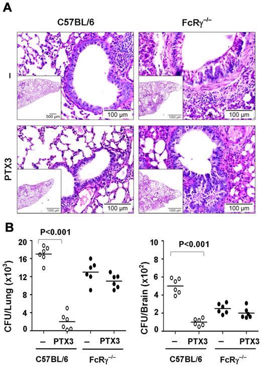 Figure 7. The therapeutic potential of PTX3 in aspergillosis is abrogated in FcRγ-deficient mice. (A) Periodic acid-Schiff–stained medial sections of lungs from C57BL/6 or FcRγ−/− mice intranasally infected with 2 × 107/20 μL viable, unopsonized Aspergillus fumigatus conidia and treated with 1 mg/kg/intranasally of PTX3 or saline for 5 consecutive days and assessed 1 day after the end of treatment. Note the presence of few infiltrates of inflammatory mononuclear cells scattered in an otherwise intact lung parenchyma in C57BL/6 mice as opposed to the abundant infiltration of inflammatory cells and signs of diffuse interstitial pneumonia in FcRγ−/− mice and its amelioration by PTX3 treatment in C57BL/6 but not in FcRγ−/− mice. Bars indicate magnification. (B) Colony forming units (mean ± SE, n = 6) in the lung and brain of C57BL/6 or FcRγ−/− mice treated with PTX3 or saline.