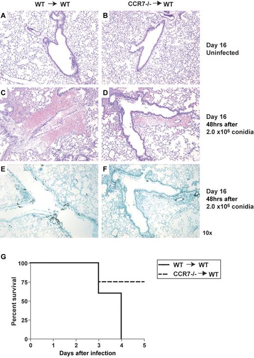 Figure 3. WT mice receiving CCR7−/− combined HSC and MPC HSCT (CCR7−/−→WT) have decreased fungal burden and increased survival, compared with WT mice receiving a WT-combined HSC and MPC HSCT (WT→WT). Lethally irradiated WT mice were reconstituted with 6.0 × 102 HSCs, 1.0 × 104 CMPs, and 1.0 × 104 GMPs from either WT or CCR7−/− mice 14 days before an intratracheal challenge with 2.0 × 106 conidia. Mice were followed for survival or harvested at 48 hours after fungal challenge. (A-F) Histologic analysis of lung tissue 2 days after conidia challenge. H&E staining of uninfected lungs (A-B) or 48 hours after conidia challenge (C-D). (E-F) Representative GMS-stained sections from WT (E) or CCR7−/− (F) mice after conidial challenge; fungal elements are stained in black. Original magnification was 10× for all sections. (G) Survival of WT mice receiving WT or CCR7−/− HSCs and MPCs (n = 4-5 mice per group, representative of 2 experiments).