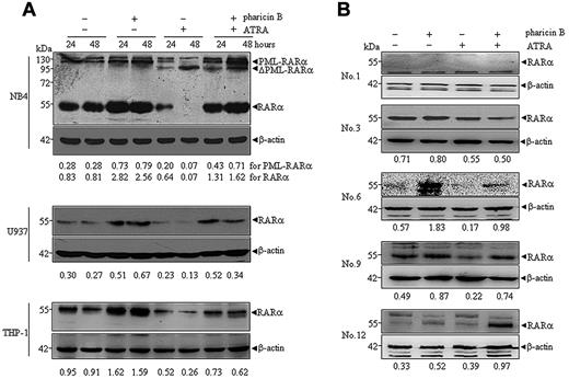 Figure 2. Pharicin B accumulates RAR-α protein in the presence of ATRA in AML cell lines and some primary cells. Cells were treated with pharicin B (2μM) and/or ATRA (10−8M for NB4 and 10−7M for U937 and THP-1) for 24 and 48 hours (A), and primary AML cells isolated from newly diagnosed patients (number represents patient numbers listed in Table 1) were treated with 2μM pharicin B and/or 10−7M ATRA for 48 hours (B). The RAR-α/PML-RAR-α protein was detected by anti–RAR-α antibody with β-actin as the loading control. The number on the bottom indicates signal intensity of RAR-α or PML-RAR-α protein against β-actin.