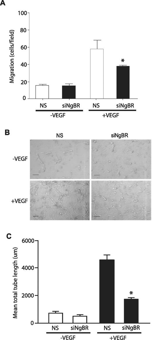Figure 4. Effects of NgBR knockdown on VEGF-induced endothelial cell migration and morphogenesis. (A) NgBR knockdown abolished VEGF-stimulated migration of HUVECs. Cell migration was examined in modified Boyden chambers in response to VEGF (100 ng/mL; n = 3). (B-C) NgBR is necessary for VEGF-induced tube formation. After treatment with either NS or NgBR siRNA, HUVECs were suspended in type I collagen gels and treated with vehicle or 100 ng/mL VEGF. After 24 hours of incubation, cells were photographed (B), and total network length was quantified (C). Representative images (B) are shown for 2 independent experiments (n = 3 in C). Scale bar = 100 μm; *P < .05; siRNA: 10nM.