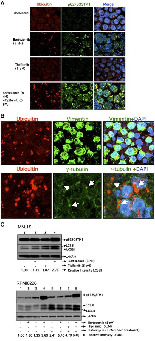 Figure 2. Assessment of autophagy. (A) Confocal images of RPMI8226 cell line treated with bortezomib, tipifarnib, or the combination for 24 hours. Images were acquired using a Zeiss LSM 510 confocal mounted on a Zeiss Axioplan 2 microscope. A 63× oil objective (NA 1.4) was used for image acquisition using Zeiss LSM software Version 4.2. All images were acquired with equivalent acquisition settings to allow for intensity measurements between samples. Images were processed in Adobe Photoshop (CS3) with equal contrast expansion for image display. Cells were stained with antibodies against ubiquitin and p62 SQSTM1antibody as well as 4,6-diamidino-2-phenylindole. Colocalization of ubiquitin and p62SQSTM1 in the merged image is visualized in yellow. (B) Confocal images of RPMI8226 cells that were treated with bortezomib and tipifarnib combination for 24 hours. Cells were stained for ubiquitin and then separately stained with vimentin and γ-tubulin. Colocalization of ubiquitin and vimentin in the merged image is visualized in yellow. γ-Tubulin is visualized in the periphery of ubiquitin aggregates distinct from the ubiquitin aggregates. (C) Western blotting for p62SQSTM1 and LC3BII inMM.1S cells and also in RPMI8226 cells in the presence and absence of bafilomycin A1. Relative intensity of LC3BII was calculated by normalizing the untreated control to a relative intensity of 1.0 and then dividing subsequent LC3BII band intensity by actin band intensity in the same treatment group using densitometry.