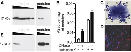 Figure 3. Aluminum nodules have features consistent with ETs. (A) Alhydrogel nodules (10 μg, 3 μg) were analyzed by Western blot for the presence of histone H3, compared with spleen cells (1.0, 0.3, 0.1, 0.03 × 106 cell equivalents). (B) Alhydrogel nodules were digested in the presence of DNase alone, proteinase K alone, or both. Absorbance of released material was measured at 280 nm. (C) Aluminum nodules were analyzed by Wright-Giemsa staining at ×1000 magnification. N indicates neutrophil; E, eosinophil; M, mononuclear cell. (D) Aluminum nodules were analyzed by immunofluorescence staining for DNA with DAPI (blue) and myeloperoxidase (red). (E) A gel identical to that shown in panel A (and run in parallel) was analyzed by Western blot for the presence of citH3. All experiments used Alhydrogel nodules collected 4-5 hours after injection and were performed at least 3 times.