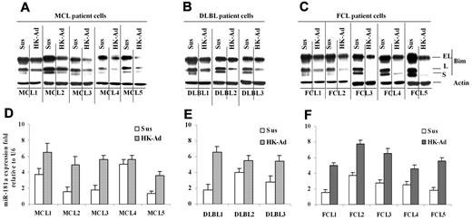 Figure 5. Cell adhesion–induced down-regulation of Bim protein level and up-regulation of miR-181a expression in primary mantle cell and other non-Hodgkin B-cell lymphomas. (A-C) Bim levels expression in primary mantle cell lymphoma (MCL, A) and diffused large B-lymphoma and follicular cell lymphoma (DLBL and FCL, B-C) cells in suspension (Sus) versus HK adhesion (HK-Ad) were analyzed by Western blot. (D-F) miR-181a expression levels in primary MCL (D) and DLBL (E) and FCL (F) cells in suspension (Sus) versus HK adhesion (HK-Ad) were analyzed by TaqMan microRNA qRT-PCR assays. Error bars represent triplicate qRT-PCR analysis for each sample.