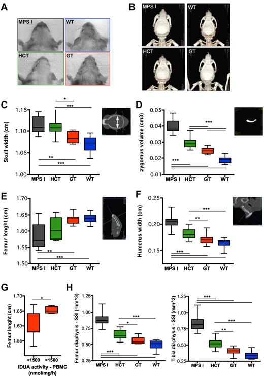 Figure 4. Differential skeletal outcome of gene therapy and HCT. (A-B) Pictures (A) and 3-dimensional reconstructions of CT scans (B) from MPS I, WT, HCT, and GT mice 6 months after treatment, showing the different gross appearance of the treated and control mice (the GT mouse shown in panels A and B had a VCN of 5.4 on bone marrow; the HCT mouse had a donor-cell engraftment of 74% on PBMCs). (C-F) Measurements of skull width (C), zygomus volume (D), femur length (E), and humerus width (F) were performed on CT scan images, as shown on the right side of each chart (see “CT” for details) from MPS I (n = 19), HCT (n = 14), GT (n = 15), and WT (n = 14). For avoiding sex biases, the femur length of only the male mice was reported (MPS I n = 10, HCT n = 10, GT n = 8, and WT n = 8); similar results were obtained in females. (G) Gene therapy–treated mice were divided into 2 groups according to the IDUA activity measured on their PBMCs. The femur length is shown for animals (males and females) having PBMC IDUA activity lower (<) or higher (>) than 1500 nmol/mg/h (1500 nmol/mg/h is the average activity value measured in the entire population of gene therapy–treated mice). (H) SSI (calculated as described in the “Peripheral quantitative CT”) was evaluated by pQCT on the diaphysis of the femur (left chart) and tibia (right chart) from MPS I (n = 19), HCT (n = 14), GT (n = 15), and WT (n = 14). Mean and min/max values are shown: *P < .05; **P < .01; ***P < .001 with 1-way ANOVA (C-F,H); *P < .05 with Student t test (G).