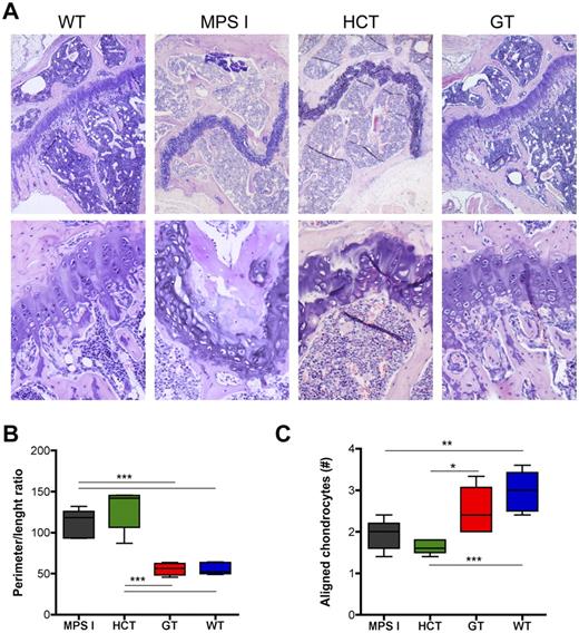 Figure 5. Differential effect on the growth plate of gene therapy and HCT. (A) Representative pictures of the proximal epiphysis of the tibiae from mock-transplanted and treated mice (hematoxylin and eosin staining), as indicated. The growth plate is disorganized and has an irregular morphology in both mock-transplanted MPS I and HCT mice (the GT mouse shown in panels A-B had a VCN of 6 on bone marrow; the HCT mouse had a donor-cell engraftment of 80% on PBMCs). Magnifications, ×5 and ×20. (B-C) The ratio between the perimeter and the length of the growth plate (B) was calculated, and the number of chondrocytes aligned in columns perpendicular to the major axis of the growth plate (C) was counted (see supplemental Figure 2 for detailed explanation) for 5 representative MPS I, HCT, GT, and WT mice (≥ 3 representative sections per mouse). Mean and min/max values are shown: *P < .05; **P < .01; ***P < .001 with 1-way ANOVA.