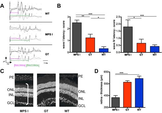 Figure 6. Effect of gene therapy on auditory brainstem responses and retina integrity. (A-B) ABRs were measured on gene therapy–treated (n = 9) and control mice (n = 9 for WT and 5 for MPS I) 6 months after treatment. (A) Representative response after auditory stimulation in WT, MPS I, and GT mice was measured as the following: for each mouse, 3 series of waves (obtained by an average of 500 electrical signals each) were recorded (shown in the top panel). In the bottom panel, the resultant wave obtained by the average of the 3 traces is shown. The latency of waves I and IV was measured as shown by the pink and green lines, respectively. (B) ABR scores of wave I (left chart) and wave IV (right chart) latencies are shown. (C-D) Retinal thickness (D) of MPS1, GT, and WT mice (n = 3) measured on ×20 magnification pictures upon DAPI (4,6 diamidino-2-phenylindole) staining, as shown in the representative images in (C). n = 3 mice analyzed per group (≥ 6 representative images per mouse). PE indicates photoreceptor layer; ONL, outer nuclear layer; INL, inner nuclear layer; and GCL, ganglion cell layer. The white bar in the picture on the left shows the measured thickness. Mean and SD are shown (*P < .05; **P < .01; ***P < .001 with 1-way ANOVA).