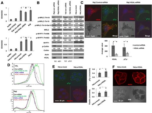 Figure 2. HGAL induces activation of RhoA downstream effectors regulating actin cytoskeleton. (A-B) Raji and VAL lymphoma cells, transfected with siRNA for HGAL or control siRNA, and HeLa cells stably transfected with pcDNA3.1-HGAL or pcDNA3.1-plasmids, were starved for 8 hours and then seeded on fibronectin for 60 minutes. (A) ROCK enzymatic activity was measured in triplicates in the indicated cells. Data are presented as mean ± SD of the mean. (B) Cellular lysates were immunoblotted for indicated proteins. Densitometry measurements of respective phosphorylated to nonphosphorylated proteins are presented. The values in control specimens were arbitrarily defined as 1. (C) Raji lymphoma cells, transfected with siRNA for HGAL or control siRNA were starved for 8 hours and then seeded on fibronectin for 90 minutes. The cells were stained with anti-HGAL (red), anti-pTyr (green) and DAPI (blue). Interference reflection contrast (IRM) images were obtained and p-Tyr staining intensity was measured and depicted as mean ± SD of the mean. (D) VAL or Raji cells transfected with siRNA for HGAL or control siRNA were starved for 8 hours and then left unstimulated or treated with LPA (1.0 μg/mL) for 45 seconds followed by staining with Alexa-488 phalloidin and analyzed by flow cytomety. (E-F) Serum-starved HeLa cells stably transfected with pcDNA3.1-HGAL or pcDNA3.1-plasmids were seeded on FN-coated slides for 90 minutes. (E) The cells were stained with anti-pTyr (green), anti-paxillin (red) and DAPI (blue); and (F) rhodamine-labeled phalloidin (red); IRM images were obtained and visualized on a Carl Zeiss LSM510/UV confocal microscope. The intensity of each staining was calculated in 25 cell tetrads as described in supplemental Mehtods and depicted as mean ± SD of the mean for p-Tyr and paxillin (E). Results in panels A through E are representative of 3 independent experiments. * indicate statistically significant difference (all below P < .01).