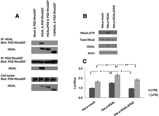 Figure 6. HGAL interacts with PDZ-RhoGEF through its C-terminal PDZ binding motif. (A) HeLa cells were co-transfected with pcDNA3.1-PDZ-RhoGEF and one of the following plasmids: pcDNA3.1, pcDNA3.1-HGAL, pcDNA3.1-HGALΔPDZ and pcDNA3.1-(1-118)HGAL. Total cellular lysates were prepared and immunoprecipitated with anti-HGAL and anti–PDZ-RhoGEF antibodies and analyzed by Western blotting with anti–PDZ-RhoGEF and anti-HGAL antibodies, as indicated. The corresponding total cellular lysates were subjected to Western blot analysis using anti-HGAL and anti–PDZ-RhoGEF antibodies. (B-C) HeLa cells transfected with pcDNA3.1, pcDNA3.1-HGAL or pcDNA3.1-HGALΔPDZ were used for RhoA pull-down (B) and analysis of luciferase activity from the SRF-driven luciferase reporter construct pSRE-Luc as described in “Luciferase reporter assays” and shown in Figures 1B and 3A. Numbers refer to luciferase activities representing means + SD of the mean of 3 independent experiments, each performed in triplicate. * indicate statistically significant difference (all below P < .01). Results in panels A and B are also representative of 3 independent experiments.