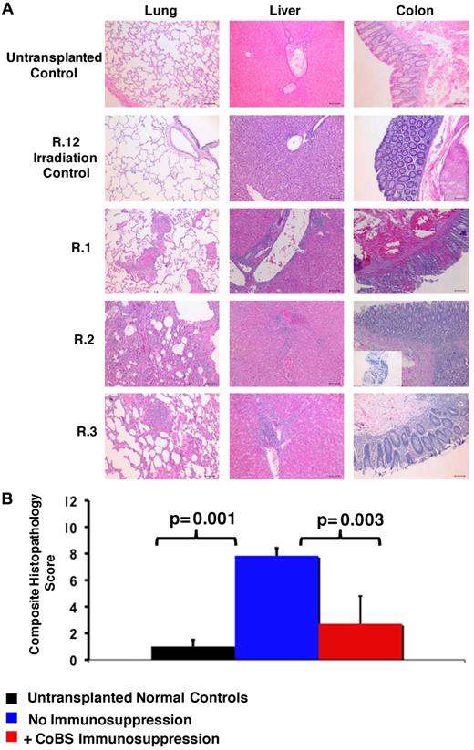 Figure 2. Histopathologic evidence of GVHD in animals that received a transplant and no immunosuppression (R.1-R.3). (A) Photomicrographs of hematoxylin and eosin (H&E) staining of the lungs, liver, and colon show GVHD in untreated animals. These studies used an Olympus BX51 microscope (Olympus America), using a 10×/0.40 UPlan Apo lens (Olympus). Slides were mounted with Permount solution (Sigma-Aldrich) and photographs were taken with the Spot RT Slider imaging system (Spot Imaging Solutions). Image analysis was performed using Spot Advanced Version 4.6 (Spot Imaging Solutions), and image processing was performed using Photoshop CS4 extended v11.01 (Adobe). (Row 1) A normal control that did not receive a transplant; (row 2) R.12, an irradiation control; (row 3) R.1; (row 4) R.2 (inset in the colon photomicrograph shows an example of CD3 staining of this organ); (row 5) R.3. Bar = 100 μm. (B) Untreated transplant recipients demonstrated significantly higher GVHD histopathology scores compared with either normal controls or CoBS-treated transplant recipients. Combined histopathologic GVHD scores for controls that did not receive a transplant (black), recipients of transplants without immunosuppression (blue), and recipients receiving CoBS immunosuppression (red) are shown. The histopathologic GVHD grading was performed by a pathologist blinded to the treatment regimens that the animals received. Individual tissue scores were from 0 (no GVHD) to 4 (severe GVHD), and the combined score was the sum of individual scores from the lung, liver, and colon.