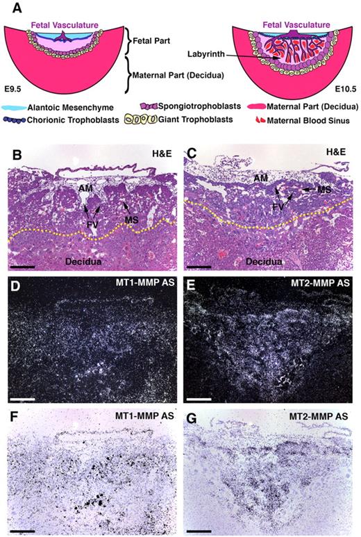 Figure 1. Mouse placental structure and expression of MT-MMPs. (A) Schematic representation of mouse placental development between E9.5 and E10.5. At E9.5, the fetal portion of the placenta is of limited size, but CHs rapidly expand the fetal portion of the placenta at this time. Fetal vessels (FVs) make their way into the prospective LA, and after differentiation of CHs, the vessels are ensheathed in 2 layers of syncytiotrophoblasts that separate the FVs from the adjacent maternal blood sinuses (MSs). This structure facilitates nutrient and gas exchange. (B-C) Hematoxylin and eosin (H&E)–stained cross sections of wild-type mouse placentas at E10.5 with abundant FVs containing nucleated red cells and MSs with enucleated erythrocytes. The yellow dotted lines in panels B-C represent the approximate border between the fetal portion of the placenta and the decidua (maternal portion). (D) Darkfield image of section serial with that shown in panel B hybridized to antisense probe (AS) for MT1-MMP. Note the abundant signal in the embryonic mesenchyme, the LA and the decidua. (E) Darkfield section serial with that shown in panel C hybridized to MT2-MMP AS. Note the signal in the trophoblasts and the limited or absent signal in decidua. (F-G) Brightfield images of sections shown in panels D-E. Note that the signal shown here is pseudocoloration of the darkfield signal projected onto the brightfield image. Scale bar (B-G): 200 μm.