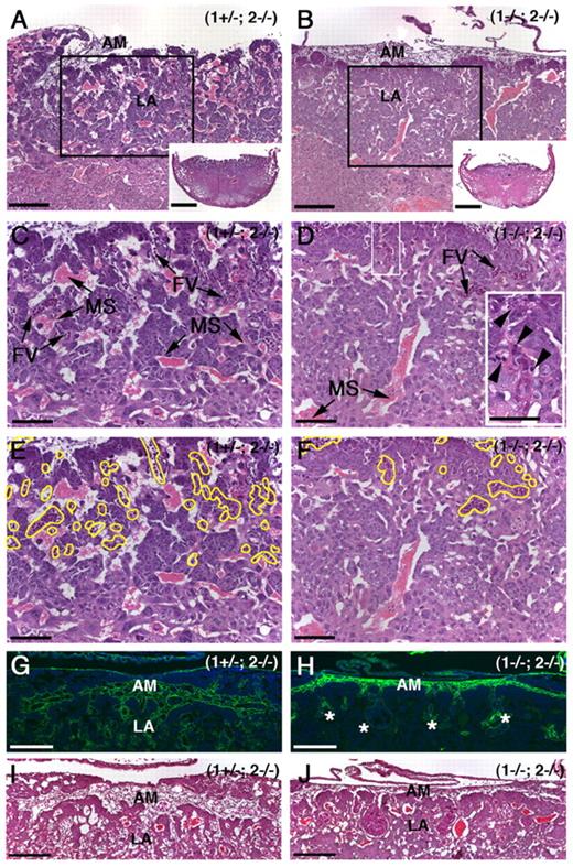 Figure 3. Loss of MT1-MMP and MT2-MMP leads to defective LA formation. (A) Cross section of H&E-stained normal placentas at E10.5 showing the AM and the placental LA with abundant FVs and MSs. Insets in (A) and (B) show entire placentas in cross section at low magnification. (B) Placenta from (1−/−; 2−/−) embryo displaying a more compact structure of the labyrinth with sparse FVs and MSs. (C) Area framed in panel A shown at high magnification. Note the abundant FVs with nucleated red cells and the adjacent MSs with enucleated red cells. (D) Area framed in panel B demonstrating the underdeveloped LA of (1−/−; 2−/−) placentas. FVs are sparse and penetrate only to a shallow depth. Top white frame is enlarged in right bottom corner and displays apoptotic bodies and dead cells surrounding the fetal vessel (arrowheads). (E-F) Same images as in panels C-D with FVs outlined in yellow. (G) Immunohistochemical localization of collagen type IV outlining FVs of the elaborately branched LA. (H) Collagen type IV–specific stain of placenta from (1−/−; 2−/−) littermate showing diminished vessel branching and penetration (asterisks) into the prospective LA. (I-J) H&E stains of sections serial with sections shown in panels G-H. Scale bars: (A-B) 200 μm; (A-B inset) 1 mm; (B-J) 100 μm.