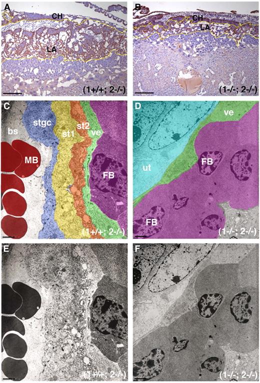 Figure 4. MT1-MMP/MT2-MMP deficiency leads to disruption of LA architecture. (A) Control placenta from E10.5 embryo stained for HAI-1. Note the localization of brown immunoreactivity in CHs and in the differentiated trophoblasts of the LA outlined in yellow. (B) The staining pattern in a (1−/−; 2−/−) littermate is confined to a more restricted area due to the poor development of the LA (yellow outline). (C) Ultrastructure of the LA from a control placenta demonstrating the trilaminar structure of the fetal vasculature. Pseudocolors show the fetal-maternal interface composed of the fetal vascular endothelium (ve, green), 2 layers of syncytial trophoblasts (st2, orange and st1, yellow) and the STGC lining the MSs (stgc, blue). Fetal blood cell (FB, purple), maternal blood cell (MB, red). Note fetal red cells are nucleated in contrast to maternal cells. (D) Pseudocolored electron microscope image shows that the 2 syncytial layers are missing in the double-deficient placenta and the MSs are not in proximity. The fetal vascular endothelium in green (ve) is surrounded by undifferentiated trophoblasts in cyan (ut). Fetal blood cells (FB, purple). (E) Unaltered version of image shown in panel C. (F) Unaltered version of image shown in panel D. Scale bars: (A-B) 200 μm; (C-F) 2 μm.