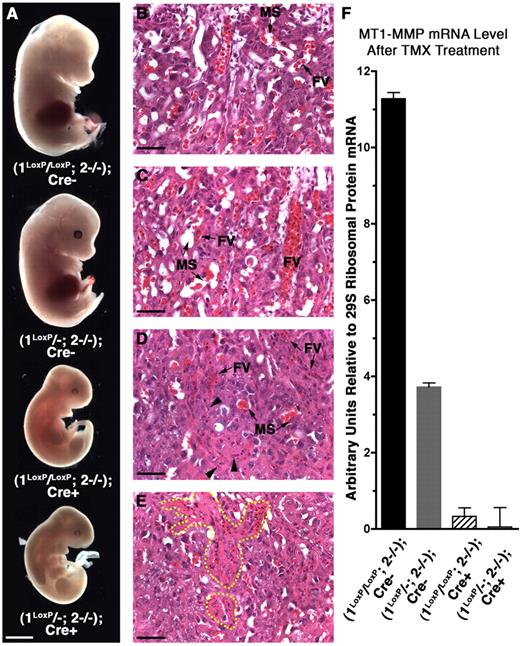 Figure 5. Early conditional loss of MT1-MMP in an MT2-MMP–deficient background replicates unconditional loss of both genes and LA disruption. (A) Whole mount images of embryos collected at E12.5 with double-deficiency induced before the formation of the LA via TMX-induced Cre-mediated excision from E7.5 to 11.5. (B-E) Corresponding LA structure of embryos in panel A. (B) Normal LA with abundant FVs and MSs juxtaposed. (C) Equivalent LA structure to that shown in panel B except the embryo is heterozygous for the unconditional MT1-MMP allele. (D) LA from Cre+ placenta displaying a LA morphology equivalent to that found in (1−/−; 2−/−) placentas featuring a compact structure and sparse vessels. Note the many dead cells (arrowheads) and the large distance between FVs and MSs. (E) LA from another Cre+ placenta demonstrating multiple dead cells around the FVs (yellow outline). (F) Relative MT1-MMP mRNA level measured by real-time PCR of embryonic tissues shown in panel A after TMX treatment. Note that TMX treatment in Cre− mice does not affect development. Scale bars: (A) 1 mm; (B-E) 50 μm.