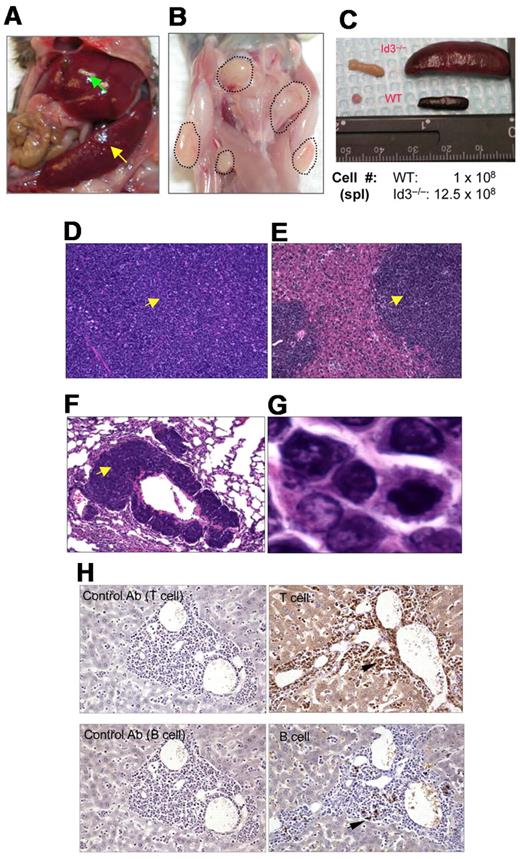 Figure 1. Mutation of Id3 results in lymphoma. (A) Splenomegaly (indicated by yellow arrow) and hepatomegaly (indicated by green arrow) in 1 representative Id3−/− mouse. (B) Massive lymphadenopathy in a representative Id3−/− mouse (highlighted with dotted lines). (C) Comparison of spleen and lymph nodes between Id3−/− (> 12 months) and age-matched WT control mice. The numbers indicate the total number of spleen cells. (D-G) H&E staining of the spleen (D), liver (E), or lungs (F) in a representative Id3−/− mouse with lymphoma. Magnification ×10. Arrows indicate neoplastic cell infiltration. (G) High magnification of tumor cells in liver (×10). (H) Immunohistochemical staining of tumor cells with CD3-specific antibody (T cell, top right) and B–cell–specific antibody (B220, B cell, bottom right). Arrows indicate positive cells. Data shown in left column are same tissues stained with isotype control antibodies (rat immunoglobulin G2a for T cell; rabbit immunoglobulin G for B cell) with no positive staining.