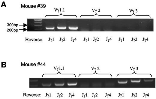 Figure 4. Vγ TCR repertoire of lymphoma cells. (A-B) mRNA analysis of Vγ TCR usage with RT-PCR; 2 mice shown are representative of the total of 5 mice examined.