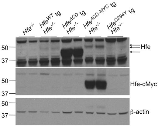 Figure 4. Analysis of Hfe transgene expression. Liver protein lysates were analyzed for Hfe (top panel) and Hfe-cMyc protein (middle panel) in 8-week-old wild-type (WT), Hfe−/−, Hfe−/− HfeC294Y, Hfe−/− Hfe-truncated transgenic (HfeΔCD tg), or Hfe−/− Hfe-cMyc transgenic (HfeΔCD−MYC tg) animals by Western blot. Equivalent loading of liver lysates was confirmed by immunoblot analysis for β-actin (bottom panel).
