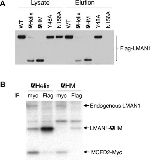 Figure 3. Oligomerization of LMAN1 is required for MCFD2 binding. (A) Mannose binding activities of different LMAN1 mutants. COS1 cells were transfected with the wild-type and the indicated LMAN1 mutants. LMAN1 proteins that are in the cell lysate and that are eluted from the mannose agarose beads are detected by Western blot analysis. Lysate lanes represent 20% of the input added to the mannose beads. (B) Co-IP of LMAN1 mutants with MCFD2. COS1 cells were cotransfected with Flag-tagged ΔHelix or ΔHM mutant and myc-tagged wild-type MCFD2. Cell lysates were immunoprecipitated with anti-myc for MCFD2 and anti-Flag for LMAN1.