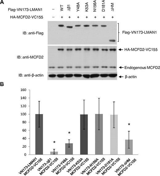 Figure 5. BiFC analysis of the interactions of LMAN1 mutants with MCFD2 in living cells. (A) Fusion protein levels in cotransfection experiments were detected by immunoblotting (IB) using the indicated antibodies. Cells were lysed immediately after microscopic observations. (B) BiFC signals relative to the wild-type LMAN1 and MCFD2 fusion proteins. Fifty cotransfected cells from each set of transfection were counted, with the background subtracted for each image. Bars represent means ± SD from 3 replicates. Statistical analysis was performed using the Student t test, and asterisks indicate significant differences (P < .05).