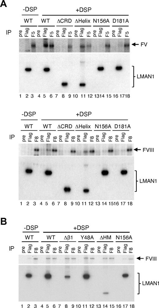 Figure 6. The Ca2+- and sugar-binding sites in the CRD interacts with FV and FVIII. COS-1 cells were cotransfected with the wild-type or indicated LMAN1 mutants, along with either FV (A) or FVIII (A-B). Cells were incubated with or without DSP before lysis. Cell lysates were immunoprecipitated with preimmune serum (pre) as a negative control, anti-Flag (Flag) for LMAN1, and anti-FV (F5) or -FVIII (F8) for the indicated coagulation factor.
