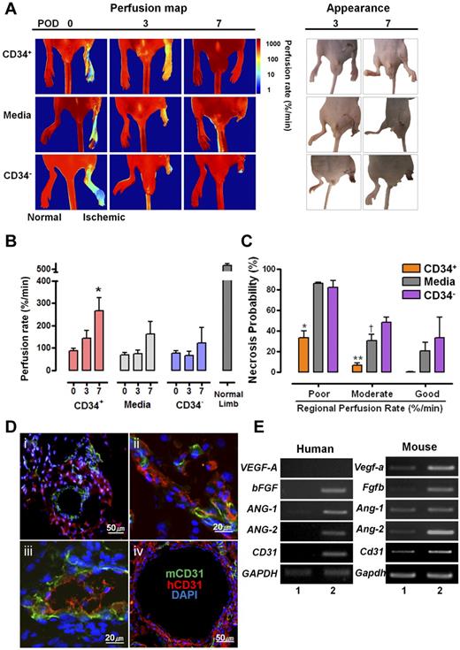Figure 6. Therapeutic effects of hESC-derived CD34+ progenitor cells on neovasculogenesis in ischemic mouse hind limbs. (A) Comparison of perfusion rates and prognosis in ischemic limbs injected with CD34+, medium, or CD34− cells. Left panel indicates indocyanine green perfusion maps obtained at 0, 3, and 7 days after surgery. The perfusion maps of day 0 show tissue perfusion distribution of the entire lower half of the body, including normal limbs. Right panel shows photographs of the hind limbs at 3 and 7 days after injection. (B) Average perfusion rates of ischemic hind limbs according to POD are indicated for each group. *P = .014 vs POD 0 (ANOVA F2,24 = 5.311, P = .012). (C) Probability of necrosis; the relationship between the probability of regional tissue necrosis on POD 7 and the tissue-perfusion rate of the corresponding region estimated immediately after surgery. The X axis shows the regional perfusion rate; poor (lower than 15%/min), moderate (16%-120%/min), and (> 120%/min). ANOVA and Scheffe post-hoc test applied to the significant effect of groups on poor and moderate perfusion rate, (ANOVA F2,3 = 27.993, P = .011. *P = .015 vs media-treated group and P = .02 vs SC34− cells-treated group with poor perfusion rate; ANOVA F2,9 = 18.872, P = .001. **P = .02 vs media-treated group and P = .001 vs SC34− cells-treated group with a moderate perfusion rate. (D) Various types of hESC-derived CD34+ cells involved in neovasculogenesis in ischemic hind limbs. hESC-derived CD34+ cells could contribute indirectly (i), partially (ii-iii), or mainly (iv) to neovasculogenesis. Immunohistochemical analysis of ischemic hindlimb regions transplanted with hESC-derived CD34+ cells. (E) Expression of angiogenic genes in the ischemic region injected with hESC-derived CD34+ cells. Human- and mouse-specific primers were used for analyzing the expression of various angiogenic genes: (1) normal hind limb tissue, (2) ischemic hind-limb tissue injected with the hESC-derived CD34+ cells.