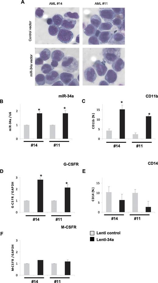 Figure 4. Overexpression of miR-34a in AML blast cells leads to granulopoiesis. Bone marrow cells derived from AML patients with CEBPA mutation (14 and 11 of Table 1) were transfected with control or miR-34a lenti viral vectors. Cells were cultured for 6 days and collected for morphologic, immunophenotypic, and myeloid marker expression analysis. (A) Morphologic analysis by light microscopy of Wright-Giemsa–stained AML blast cells. (B) miR-34a expression levels in blast cells transfected with lentiviral miR-34a vector, in comparison with control vector, as analyzed by real-time RT-PCR analysis. (C,E) CD11b (C) and CD14 (E) expression levels in blast cells transfected with lenti viral miR-34a vector, in comparison with control vector, as analyzed FACS analysis. (D,F) G-CSFR (D) and M-CSFR (F) expression levels in blast cells transfected with lenti viral miR-34a vector, in comparison with control vector, as analyzed by real-time RT-PCR analysis. Data are represented as mean ± SD from 3 independent experiments. *P < .05.