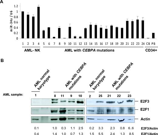 Figure 3. miR-34a functions as a tumor suppressor in AML with CEBPA mutations. (A) Quantitative real-time RT-PCR for miR-34a was carried out using bone marrow cells derived from AML patients. Values were normalized with U6. AML-NK, AML with normal karyotype; CB, cord blood; PB, peripheral blood. Data are represented as mean from 3 experiments. (B) Western blot analysis for E2F3 and E2F1 were carried out using bone marrow cells derived from AML patients. Values below the gel image indicate the E2F3 and E2F1 protein levels normalized to actin. (C) Growth curve of Kasumi-6 cells transfected with control or miR-34a.pCDNA vectors. Data are represented as mean ± SD from 3 independent experiments. (D) Flow cytometry of propidium iodide–stained Kasumi-6 cells transfected with control or miR-34a.pCDNA vectors from a representative experiment. (E) Cell-cycle profile of Kasumi-6 cells 2 days after transfection with control or miR-34a.pCDNA vectors. Data are represented as mean ± SD from 3 independent experiments. *P < .05, **P < .001.