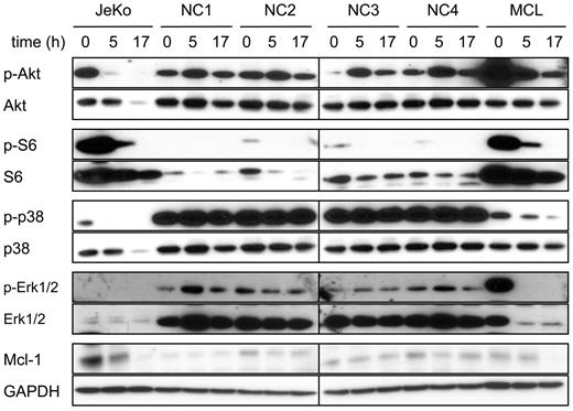 Figure 5. Actions of 8-NH2-Ado on Akt and Erk signaling pathways of peripheral blood monocytes. Freshly isolated PBMCs in 10% fetal bovine serum (FBS), RPMI were incubated continuously with 3μM 8-NH2-Ado for 0, 5, and 17 hours. Lymphoma cells from a lymphoma patient (MCL) were collected from the peripheral blood and allowed to proliferate in culture (20% FBS in Dulbecco modified Eagle medium). Once sufficient cell counts were obtained, the lymphoma cells were incubated continuously with 3μM 8-NH2-Ado for 0, 5, and 17 hours. JeKo cell lysates (Figure 4) were used for comparison. Cell lysates (30 μg) were immunoblotted for phospho- and total protein levels as shown. GAPDH was used as a loading control.