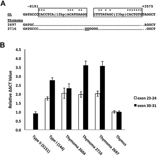 Figure 6. Detection of 5′ deletions and aberrant Notch1 transcripts in primary murine “thymomas.” (A) Sequences of PCR products obtained by amplification of genomic DNA isolated from 2 thymic lymphomas with primers flanking the most common breakpoints associated with type 1 aberrant transcripts. Sites of DNA breakage and joining, as deduced from sequencing of PCR products, are shown. Residues matching the consensus RAG recognition sequence (CACAGTG followed by a 12- or 23-bp spacer and the sequence ACAAAAAAC) are denoted with an asterisk. N nucleotides and P nucleotides (underlined) are also shown. GL indicates germline DNA flanking the breakpoints. Boxes represent sequences resembling RAG signal sequences. (B) Ratiometric Notch1 quantitative RT-PCR analysis. The relative amounts of transcripts containing 5′ (exons 23 and 24) and 3′ (exons 30 and 31) Notch1 sequences were determined for the tumors in panel A and normal murine thymus, a cell line with a homozygous type 2 deletion (135.2), and a cell line with a heterozygous type 1 deletion (144). Each determination was made in triplicate. The results shown are representative of 2 independent experiments.