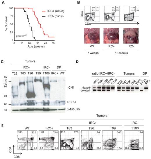 Figure 1. RBP-J deletion delays T-ALL development. (A) Survival curves of IkL/LRBP-Jf/fCD4-Cre+ (IRC+) mice and IkL/LRBP-Jf/fCD4-Cre− (IRC−) mice. The statistical significance was calculated by log-rank test. Note that the 2 IRC+ mice killed at 52 weeks did not show signs of disease. (B) Thymocyte CD4/CD8 profiles as determined by flow cytometry (top) and photos of the thoracic cavity (bottom) from 18-week-old IRC+ and IRC− mice and a 7-week-old WT mouse. (C) Western blot of RBP-J and ICN1 (Val1744 antibody) expression in a panel of thymic tumors from IRC+ mice. Control samples are an IRC− tumor and sorted CD4+CD8+ (DP) cells from 4-week-old IRC+ and WT mice. α-Tubulin was used as a loading control. The variable sizes of the ICN1 proteins are likely due to C-terminal truncations. Note that the deletion of the RBP-J floxed sequences effectively leads to loss of RBP-J proteins in nontransformed IRC+ DP cells. (D) PCR analysis of the deletion of the floxed sequences in the samples shown in C. The left panel shows amplification of control samples consisting of mixes of DNA from IRC+ and IRC− thymocytes, at the indicated ratio. (E) CD4/CD8 profiles of samples shown in panel C, except for T22 where the FACS profile was not available.
