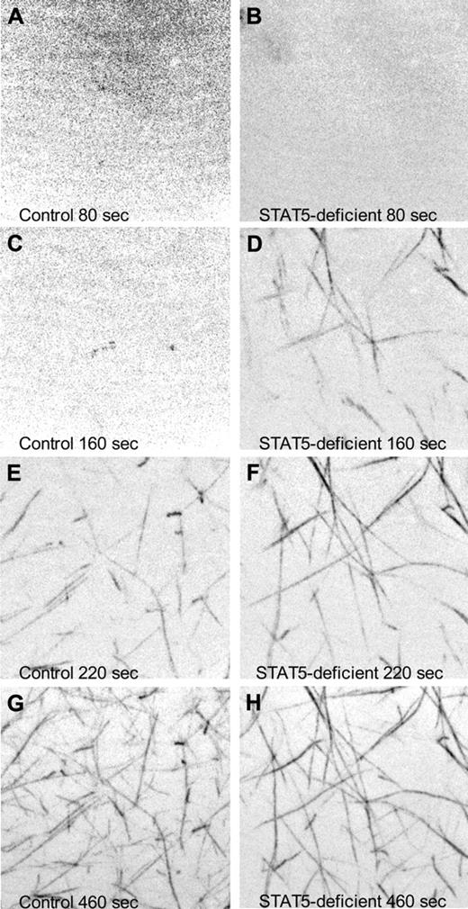 Figure 5. Confocal microscopy of fibrin polymerization. Platelet-poor plasma isolated from control (left panels) and STAT5-deficient (right panels) mice was supplemented with 80 μg/mL human fibrinogen labeled with AlexaFluor 488. Thrombin-triggered clotting was initiated in the center of a 35-mm glass-bottomed dish, and polymerization was recorded at 37°C using a Nikon Ti inverted microscope, 100×/1.49 Apo TIRF objective, Yokogowa CSU-X1 spinning disk confocal unit with 486 nm DPSS laser source, and a Photometrics Cascade II 512 camera. Images are maximum intensity projections of 5-μm stacks at the indicated time points. No discernable fibers were present at the beginning of capture (A-B). Fibrin fibrils first appeared at 120 seconds in STAT5-deficient plasma (C-D) and 180 seconds in control plasma (E-F). At 460 seconds, both control and STAT5-deficient plasma had established extensive fibrin networks (G-H).