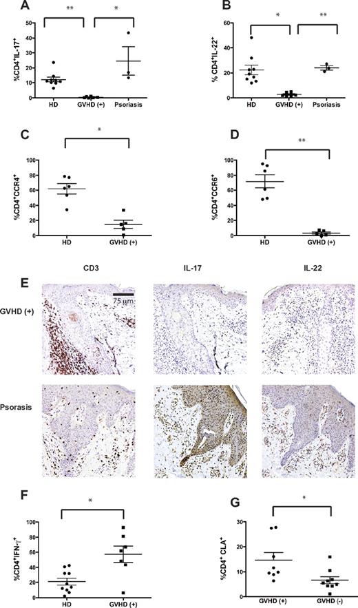 Figure 2. Skin affected by cutaneous GVHD is enriched in Th1 but not Th17 cells. Punch biopsies from skin affected by aGVHD collected at the time of diagnosis (n = 7), psoriasis (n = 3), and healthy controls (n = 10) were cultured on 3-dimensional matrices in the presence of T-cell growth factors. After 3 weeks, suspension cells were restimulated with phorbol myristate acetate and ionomycin and gated CD4+ T cells were analyzed for the proportion of (A) IL-17 (GVHD+, 0.44% ± 0.18%; psoriasis, 24.6% ± 9.46%; healthy donors, 12.24% ± 1.60%), (B) IL-22 (GHVD+, 2.72% ± 0.61% psoriasis 24.05% ± 1.74%; healthy donors, 22.4% ± 3.82%), and (F) IFN-γ–producing cells (GVHD+, 57.36% ± 10.75%; healthy donors, 21.06% ± 4.63%). Unstimulated samples were analyzed for expression of (C) CCR4 (GVHD+, 14.88% ± 5.44%; healthy donors, 61.80% ± 6.73%) and (D) CCR6 (GVHD+, 3.4% ± 1.46%; healthy donors, 71.97% ± 8.87%). (G) Expression of cutaneous lymphocyte-associated antigen on circulating CD4+ T cells was measured in patients with cutaneous GVHD (14.69% ± 2.99%, n = 8) and compared with time-matched transplanted patients without GVHD (6.62% ± 1.43%, n = 9). (E) CD3 staining was used to identify T-cell infiltrates, and IL-17/IL-22 staining was used to identify cytokine expression patterns in the skin of patients with aGVHD (n = 6) and psoriasis (n = 1). The sections were examined using an Olympus BX61 microscope equipped with a 20×/0.75 objective lens and images were taken with an Olympus DP71 digital camera and acquired with DP controller 3.1.1.267 Olympus software. *P < .05. **P < .0001. Error bars represent SEM.