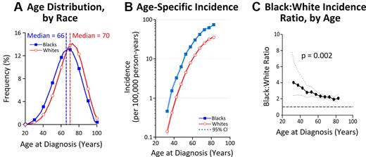 Figure 2. Incidence patterns of MM by race and age, 1973-2005 (SEER-9).