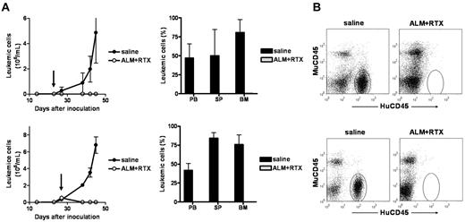 Figure 7. Synergistic effect of ALM and RTX in vivo. Animals were inoculated with primary leukemic cells from patient 24 (top) or patient 15 (bottom). Starting from the time points indicated by the arrows, animals received 250 μg ALM plus 250 μg RTX (A + R) or saline daily for 5 days per week for a total of 3 weeks. For each case, 2 independent experiments were performed with 3 treated animals and 3 control animals per group. Data are mean ±SD of all measurements. (A) Leukemic cell counts in peripheral blood (PB) during treatment, and leukemic cell content of PB, spleen (SP), and bone marrow (BM) at the experimental endpoint. Treatment start is indicated by arrows. (B) Flow cytometric analysis of bone marrow of ALM + RTX–treated and control treated animals. Cells were stained with antimurine CD45 (muCD45) and antihuman CD45 (HuCD45). The elliptic gate indicates the location of leukemic cells.