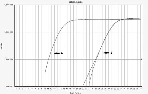 Figure 3. Detection of child microchimerism by QT-PCR. (A) The mother's allele, or major allele, has low cycle number corresponding to its comparatively high DNA concentration. (B) The minor allele or microchimeric cell population has a much higher cycle number because the minor DNA exists at a much lower concentration than the major allele. The method is to calculate the change in cycle threshold (ΔCT) to show the ratio of the minor population to the major population.
