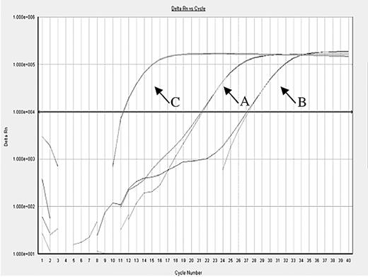 Figure 4. Monitor the infused mother's lymphocyte by QT-PCR in patient 3. (A) The mother's allele before lymphocyte infusion. (B) The mother's allele 13 months after lymphocyte infusion. (C) The child's allele or the major allele.