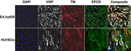 Figure 1. Fluorescent confocal micrographs of HUVECs and EA.hy926 hybridoma cells. All images were obtained at a magnification ×400 using a 40X oil immersion objective under identical settings for focus and image capture. EPCR (green), VWF (white), TM (red), and 4,6′-diamidino-2-phenylindole (DAPI; blue) are shown in split xy along with a merged image (composite) as viewed by Zeiss LSM 5 image viewer software.