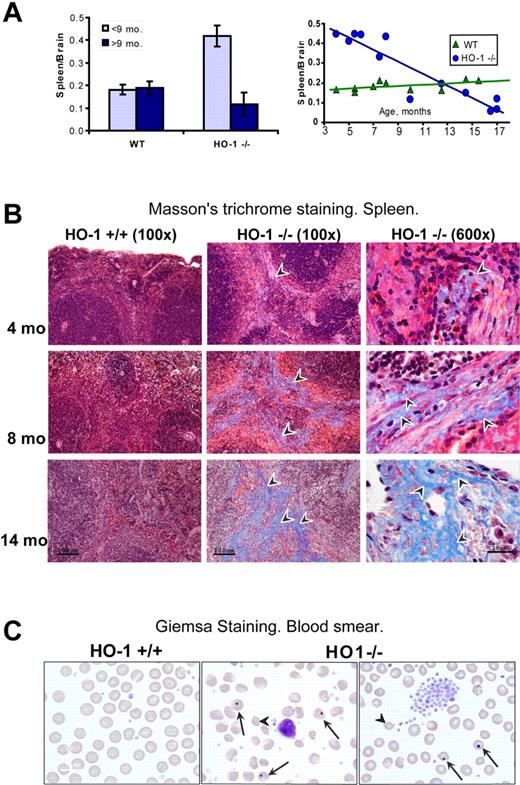 Figure 1. Splenic atrophy and fibrosis were associated with functional hyposplenism in aging HO-1−/− mice. (A) In mice younger than 9 months, the spleen to brain weight ratio of HO-1−/− mice (n = 6) was 2.3-fold (P < .001) higher than in WT (n = 6), whereas HO-1−/− mice older than 9 months (n = 6) had on average 1.6-fold (P < .05) smaller spleens than their WT counterparts (n = 4). Error bars represent SD of the mean. Graphing of individual spleen/brain ratios (right panel) indicated that splenic swelling was notable in young HO-1−/− mice, whereas older mice had progressively more severe atrophy. (B) Progressive fibrosis developed in the red pulp of aging HO-1−/− mice as observed by Masson trichrome histochemistry. Arrowheads point to collagen fibers, which appear as blue streaks. (C) Peripheral blood smears of HO-1−/− mice showed increased numbers of abnormally shaped RBCs (arrowheads) and numerous cells with Howell-Jolly bodies (arrows). Four animals from each group were examined. One typical sample of WT and 2 of HO-1−/− (14 months old) are shown.