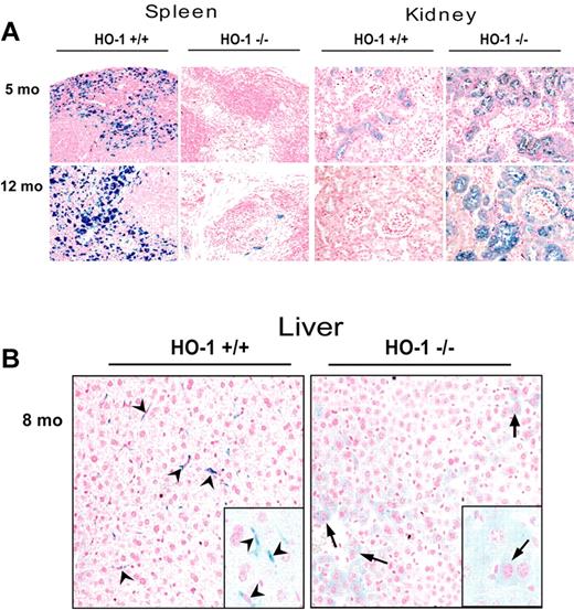 Figure 5. Redistribution of iron from splenic and hepatic macrophages to hepatocytes and renal proximal tubule cells in HO-1−/− mice. (A) Perls Prussian blue staining of paraffin-embedded tissue sections revealed pronounced high iron levels in splenic macrophages of the WT, compared with almost undetectable macrophage iron in the HO-1−/− animals, whereas very little iron was detected in renal proximal tubules of the WT, but iron levels were greatly increased in the renal proximal tubules of HO-1−/− mice. Slices of paraffin-embedded tissue from 2 mice (5 and 12 months old) for both WT and HO-1−/− are shown. (B) Redistribution of iron in liver from Kupffer cells (arrowheads), which were absent in HO-1−/− mice, to hepatocytes (arrows). (Inset) A 2.5-fold digital magnification of an area from the adjacent field, to better demonstrate the different morphologies of iron-containing cells in WT versus HO-1−/− animals.