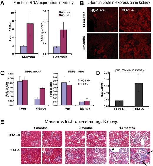 Figure 6. Increased L- and H-ferritin, FPN1, and MRP2 expression and fibrosis in HO-1−/− kidneys reflected the shift of heme-iron recycling. (A) Both L and H ferritin mRNA expression levels were increased in kidney of HO-1−/− mice. L ferritin increased 4.1-fold (P < .01) and H ferritin increased 3.5-fold (P < .01) as revealed by quantitative RT-PCR. Animals 8 months of age (n = 4 in each group) were used to generate data that are represented in panels A, C, and D. Error bars represent SD of the mean. (B) Immunofluorescence analysis for L-ferritin indicated that protein levels were also increased in the HO-1−/− kidney. Most ferritin protein was found in proximal tubules and in some glomeruli. This pattern replicated the iron localization pattern revealed by the Perls Prussian blue staining and suggested that most accumulated iron in kidney was stored in the form of ferritin. (C-D) mRNA expression levels of MRP2, MRP3 normalized to actin-β, and FPN1 normalized to glyceraldehyde-3-phosphate dehydrogenase (GAPDH) expression were obtained by quantitative RT-PCR. (C) A 2.7-fold increase (P < .001) in expression of the apical membrane exporter of conjugated bilirubin, MRP2, in HO-1−/− kidney suggested that heme degradation occurred in the polarized cells of the proximal tubules. Levels of MRP3, a widely expressed bilirubin exporter of nonpolarized cells, including macrophages, remained unchanged. mRNA levels of MRP2 and MRP3 remained unchanged in liver. (D) A 4-fold increase (P < .01) in FPN1 mRNA expression was observed in kidney, which probably served to return iron from catabolized heme to the circulation. (E) Fibrotic damage occurred to the kidney of HO-1−/− mice as a result of heme iron recycling, as seen on Masson trichrome–stained paraffin-embedded tissue sections, where fibrosis developed in aging HO-1−/− mice at much higher levels than in WT animals. Arrows indicate collagen fibers, which are colored in blue.