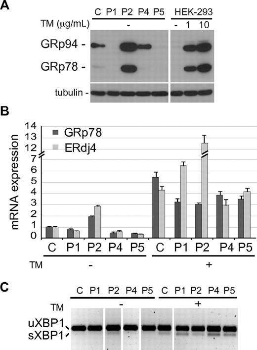 Figure 6. UPR induction in P2 BLCL. (A) Immunoblot showing the expression level of GRp78 and GRp94 in control (C) and patient's BLCLs. HEK-293 cells, untreated (-) or treated for 6 hours with 2 different doses of Tunicamycin (TM) are shown as control of UPR induction. Tubulin was used as loading control. (B) Real-time PCR analysis of GRp78 and ERdJ4 mRNA expression, in C and mutant BLCLs, untreated or treated with TM. Expression values, relative to β-actin, are normalized to the expression observed in C. The experiment shown is representative of 2 independent experiments with triplicate samples, and data are given as means ± SD. (C) RT-PCR analysis of XBP1 mRNA, spliced (sXBP1) and unspliced (uXBP1). The experiment shown is representative of 2 independent experiments. Vertical lines have been inserted to indicate repositioned gel lanes.