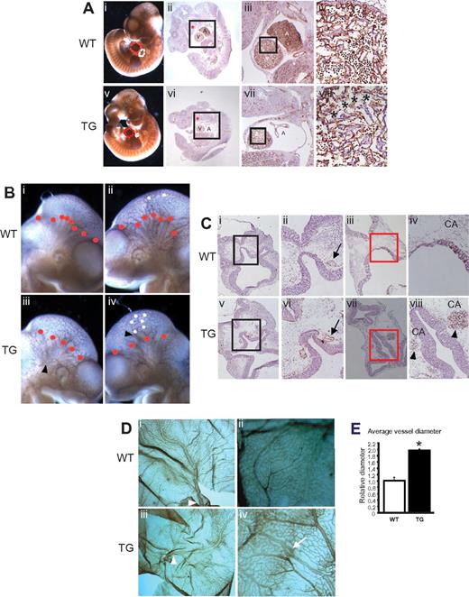 Figure 3. Embryonic Egfl7 overexpression causes defects in the developing heart and in head and yolk sac vasculature. (A) CD31 immunostaining of whole-mount wild-type (i) and transgenic (v) embryos at E10.5. White and red lines represent the atrium (A) and ventricle (V), respectively. Original magnification ×30. CD31 immunostaining of parasagittal sections of wild-type (ii-iv) and Tie2-Egfl7 transgenic embryos (vi-viii). High-magnification images of black-boxed areas in subpanels ii and vi (iii,vii). High-magnification images of boxed areas in subpanels iii and vii (iv,viii). Original magnification ×1.25 (ii,vi), ×4 (iii,vii), and ×20 (iv,viii). Black asterisks represent reduction in traberculation; and red asterisks, branchial arch. (B) CD31 immunostaining of whole-mount embryos at E10.5. Tie2-Egfl7 transgenic embryos (iii-iv) showed abnormal endothelial aggregates (arrowheads), a decrease in the number of major cranial vessels (red dots), and increased branching (white dots) compared with wild-type littermates (i-ii). Original magnification ×60. (C) CD31 immunostaining of cross sections from wild-type (i-iv) and Tie2-Egfl7 transgenic embryos (v-viii) at E10.5. High-magnification images of black-boxed areas in subpanels i and v (ii,vi). High-magnification images of the boxed areas in subpanels iii and vii (iv,viii). Arrows indicates carotid artery (CA); and arrowheads, hemorrhaging from CA. Original magnification ×4 (i,iii,v,vii) and ×10 (ii,iv,vi,viii). (D) CD31 immunostaining of E12.5 wild-type (i-ii) and transgenic (iii-iv) yolk sacs. Arrowheads indicate vitelline vessels; and arrow, knot-like structure in vein. Quantification of vitelline vessel diameter in wild-type (□, n = 2) and transgenic (■, n = 4) yolk sacs. (v) *P < .03. Original magnification ×25.5 (i,iii) and × 41 (ii,iv). Whole-mount images were captured on Discovery V20 Stereomicroscope (Carl Zeiss) and immunohistochemistry images on the Axioplan 2 Imaging Upright Microscope (Carl Zeiss).