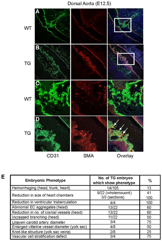 Figure 4. Tie2-Egfl7 transgenic mice exhibit defects in vascular cell stratification at branch points of the dorsal aorta. Immunofluorescence staining of the dorsal aorta at E12.5. CD31+ cells are shown in green (Alexa Flour 488), and SMA+ cells are shown in red (Cy3). Images were captured on the TCS AOBS SP2 microscope (Leica). (A-B) Wild-type and transgenic dorsal aorta, respectively. Original magnification 20×/0.7NA, water objective. (C-D) High-magnification image of boxed areas in panels A and B. Original magnification 63×/1.2NA, water objective. (E) Summary of phenotypes observed in Egfl7 transgenic embryos.