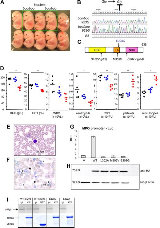 Figure 5. The booreana ENU strain harbors a point mutation in the transactivation domain of c-Myb. (A) Homozygous booreana mutants (boo/boo) appear normal at E14.5. (B) Resequencing of c-Myb (ENSMUSG00000019982) from 2 phenotype-positive embryos identified an A-to-G transition in both cases in exon 8 at base pair 923, changing amino acid 308 from glutamic acid to glycine. (C) Domain structure of c-Myb showing the E308G point mutation in the transactivation domain. DNB indicates DNA binding; TA, transactivation/acidic; and NRD, negative regulatory. (D) Complete blood counts of 8-week-old booreana homozygous and heterozygous mutants and wild-type littermate controls as measured by ADVIA 2120 machine. *Statistically significant differences (P < .05) between boo/boo and +/+ groups. **Significance between boo/boo and both +/+ and boo/+ groups. (E-F) Blood films of 12-week-old boo/boo mice (E) and boo/+ littermates (F). The mutant animals have increased platelets, polychromasia (p), and Howell-Jolly bodies (arrowheads) and basophilic stippling (s). For panels E and F, images were generated using an Olympus BX51 microscope with a U PlansApo 60× lens, 1.35 NA, under Olympus imersion oil. Images were collected using an Olympus DP70 camera and DP controller software. Digital images were adjusted and labeled using Photoshop CS4. (G) Reporter assays in 293T cells cotransfected with the myeloperoxidase gene promoter linked to lacZ and various HA-tagged c-Myb constructs, including wild-type (WT), L302A, M303V, and E308G (Booreana) mutations within the TA domain. Bars represent mean normalized relative light units (RLU), and error bars represent SD of the mean of triplicate biologic assays. (H) Western blot of transfected 293T cells for the HA tag and for endogenous β-actin showing equivalent transfection efficiency. (I) GST pull-down assays showing interactions between GST-CBP-KIX (KIX) and in vitro translated c-Myb mutants. Input (ipt) and bound wild-type (WT), E308G, or L302A radiolabeled c-Myb proteins eluted from the indicated GST fusions are shown in top panel; the bottom panel shows the presence of the relevant GST proteins, visualized by Coomassie blue staining, in each binding reaction.